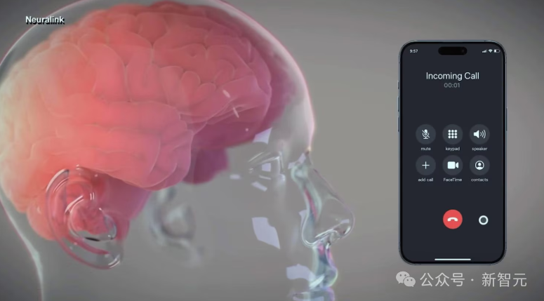 Neuralink芯片入脑让瘫痪男子重新开口,家属泪崩!插图3 Neuralink芯片入脑让瘫痪男子重新开口,家属泪崩!插图3